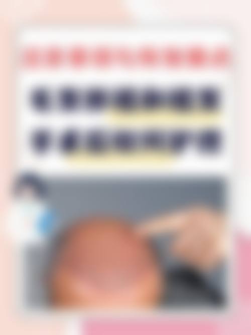 结尾预约号召 金大原医生