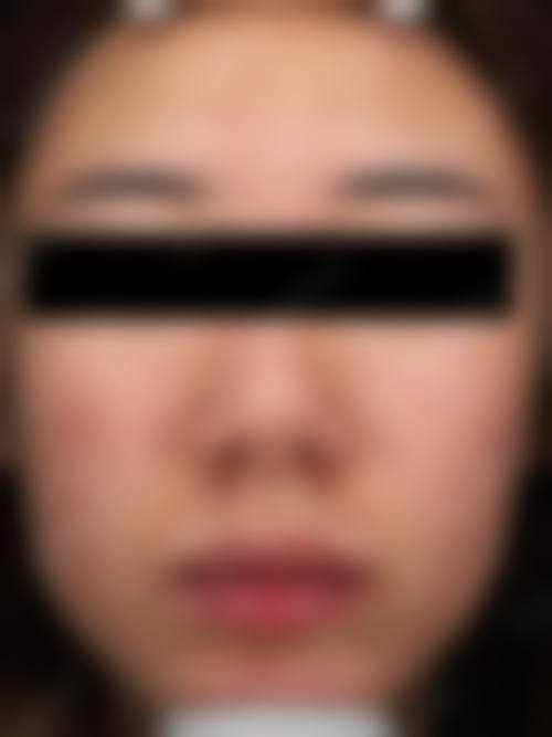 预约优惠活动 太原美莱医疗整形美容医院