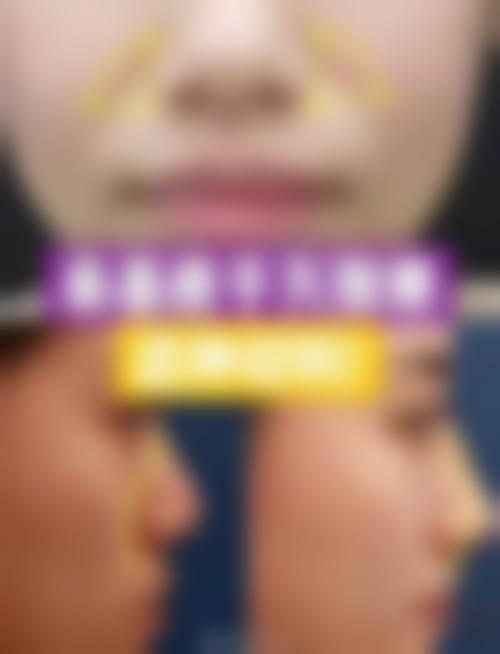 预约优惠活动