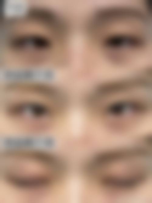 擅长项目详解 太原美莱医疗整形美容医院