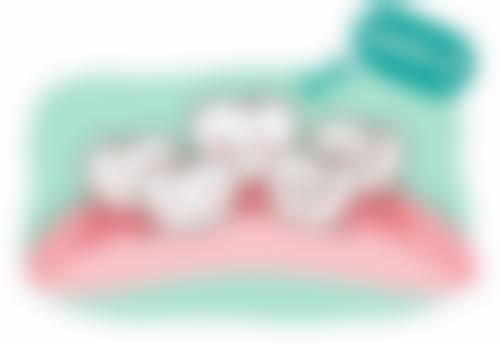 外源性着色时洗牙的作用