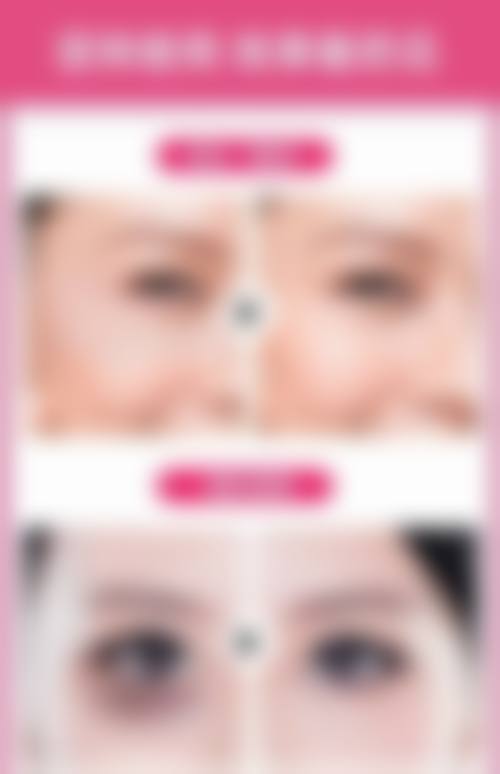 临床实例分享