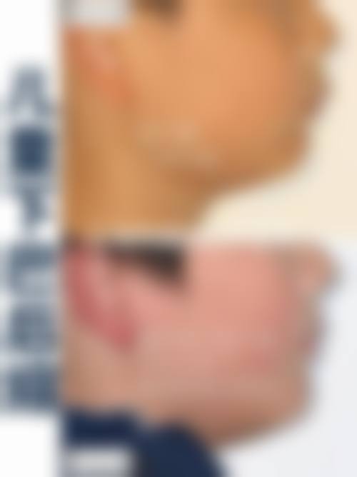 预约优惠活动