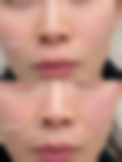临床实例分享