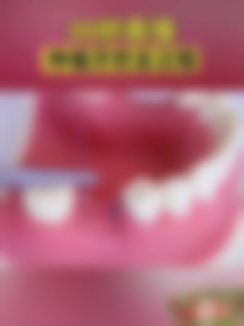 优惠活动详情