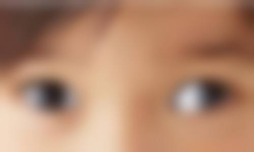 特色诊疗项目与技术优势:中医和西医结合,解决眼疾根本