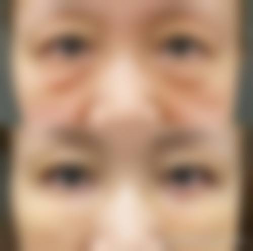 预约优惠活动