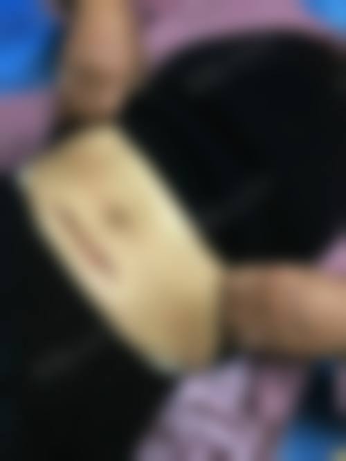 预约优惠活动:现在预约黄城医生有什么补贴?