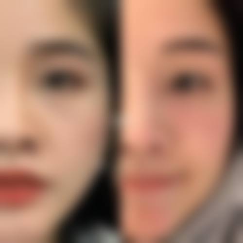 擅长项目详解