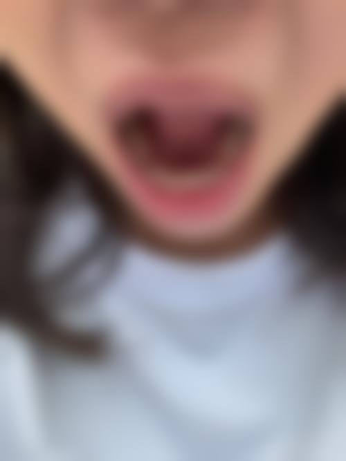 优惠活动详情