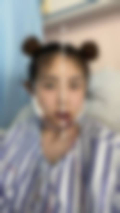 临床实例分享