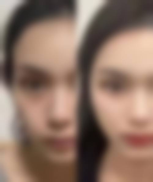 四、优惠活动详情：限时补贴等你来