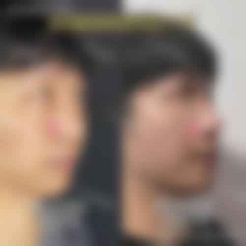 服务流程:全程无忧,术后管理