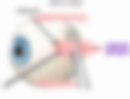 优惠活动详情：白内障手术原价12000元-优惠价8800元，限时预约