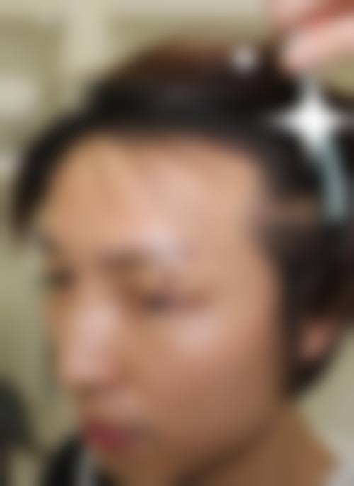 服务流程与预约方式:骨干医生面诊+个性化方案+术后保护