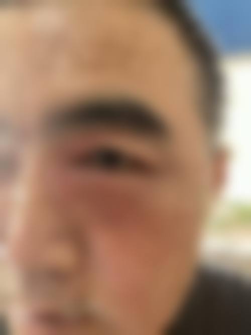 Q：医院支持医疗保险报销吗？