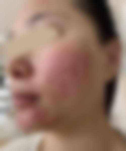 预约优惠活动