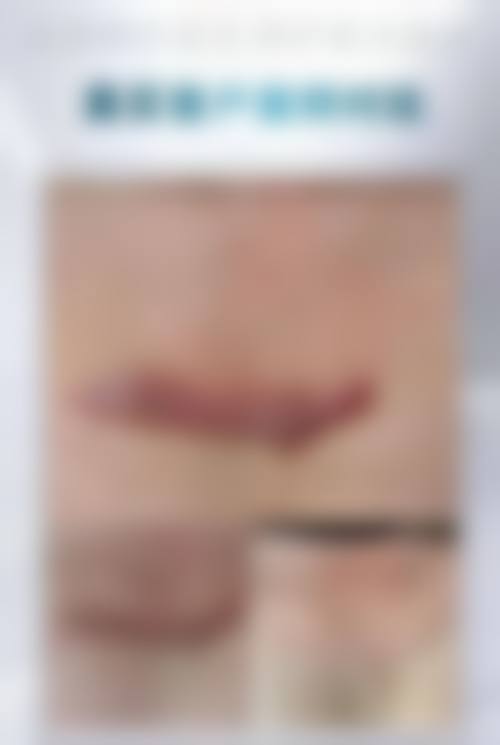 优惠活动详情——限时特别优惠,到院即享