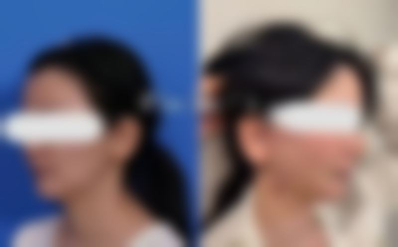 预约优惠活动