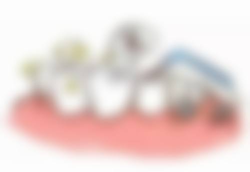 柳州蓝天口腔矫正牙齿价格及优势