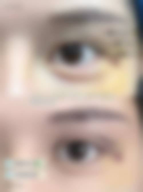 预约优惠活动