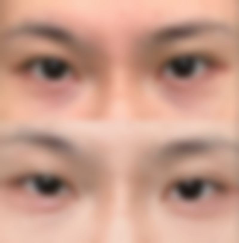 如何预约淮南丽人医院整形美容科熊秋萍医生?