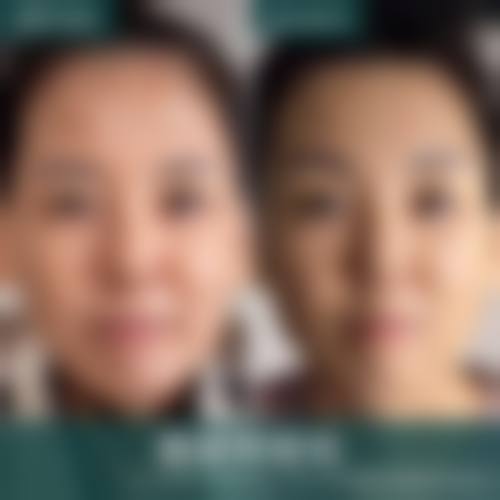 菏泽美莱整形医院的技术优势体现在哪?