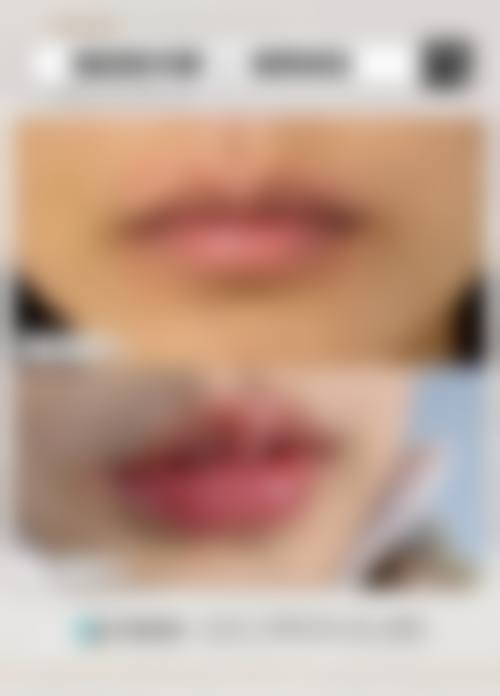 怎么预约李化训医生?挂号和预约方式