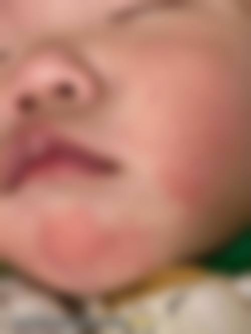 擅长项目详解