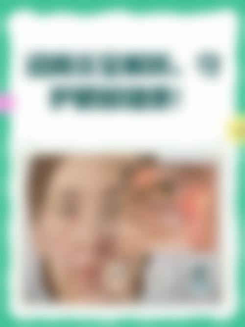 预约优惠活动