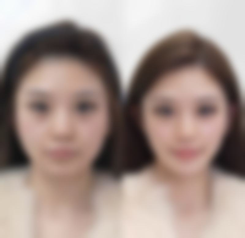 在吉林海茵医疗美容诊所找李若华医生做治疗，口碑如何？