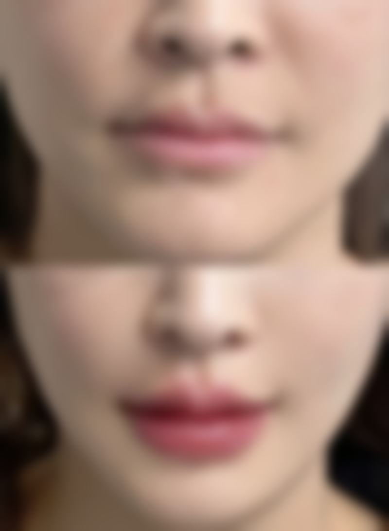 如何预约吉林海茵医疗美容诊所的万鹏医生?