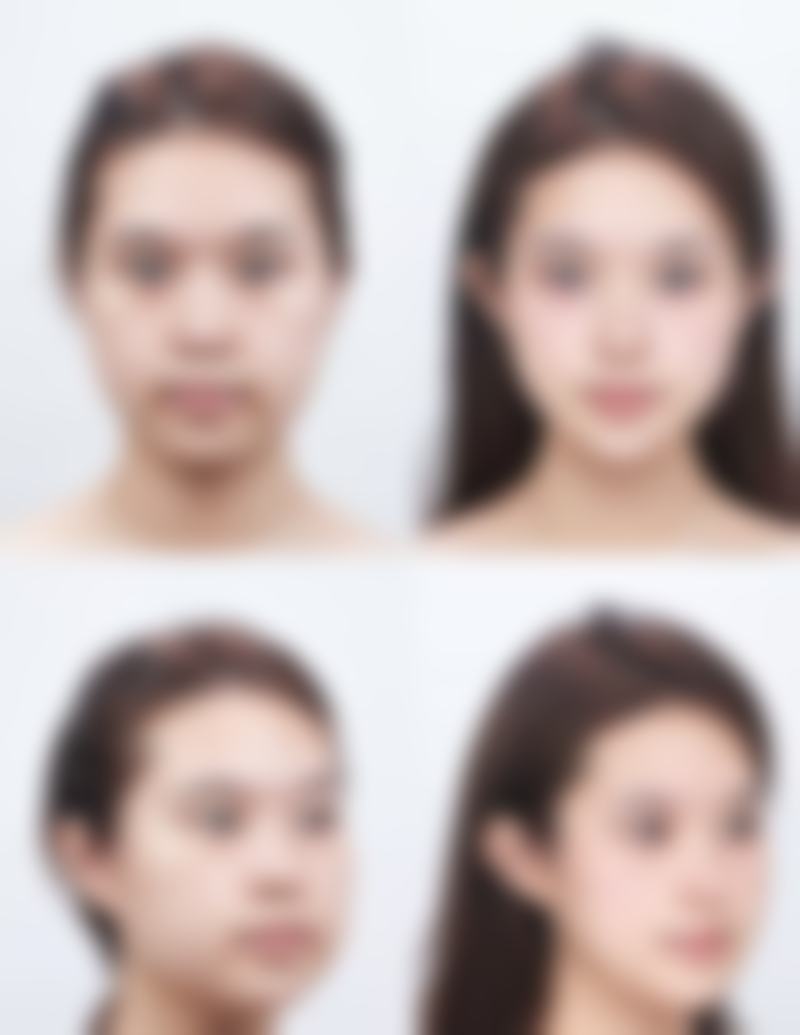 菏泽美莱整形医院正规吗?资质与实力详解