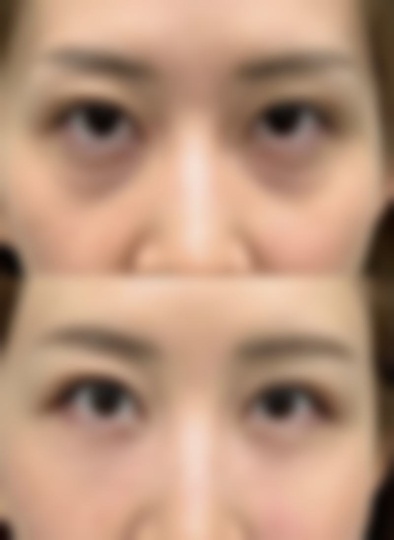惠州摩登美学整形医院2026年收费标准参考