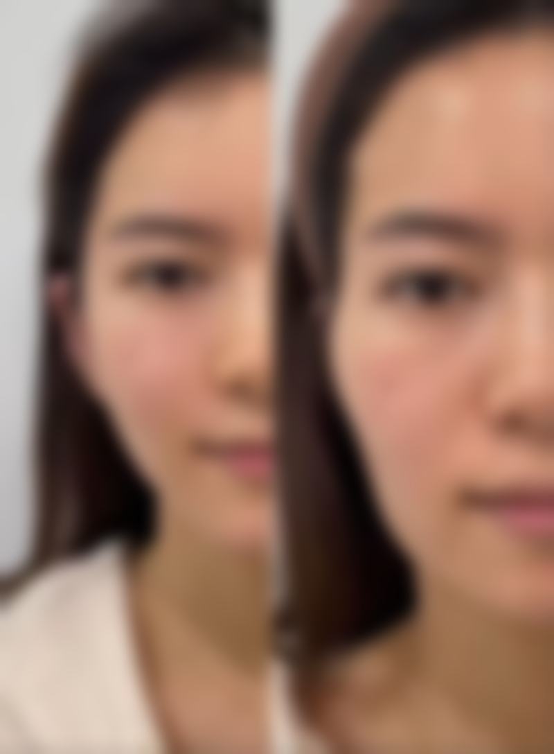 吉林海茵医疗美容诊所万鹏医生的技术怎么样?值不值得信赖?