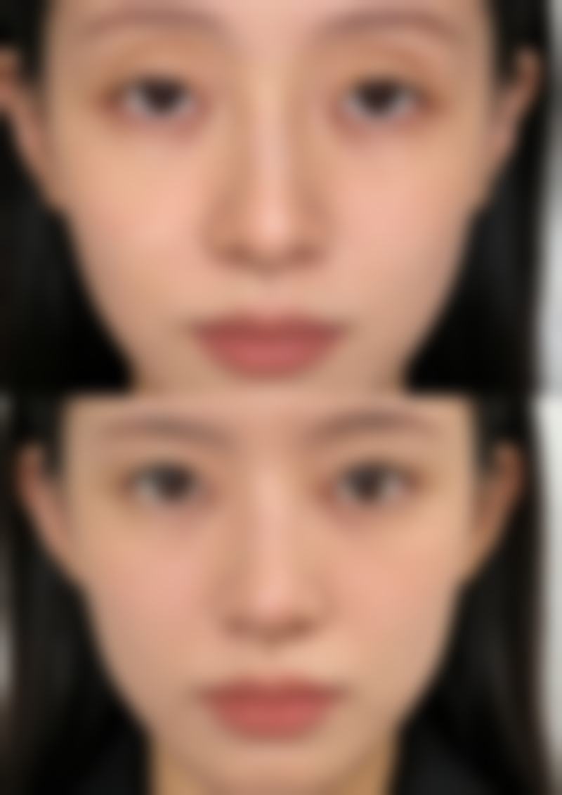 菏泽美莱整形医院擅长哪些特色项目?