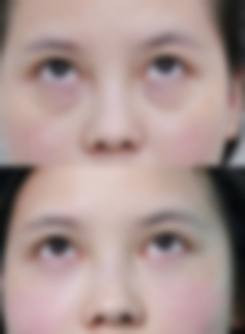 菏泽美莱整形医院预约挂号与到院方式